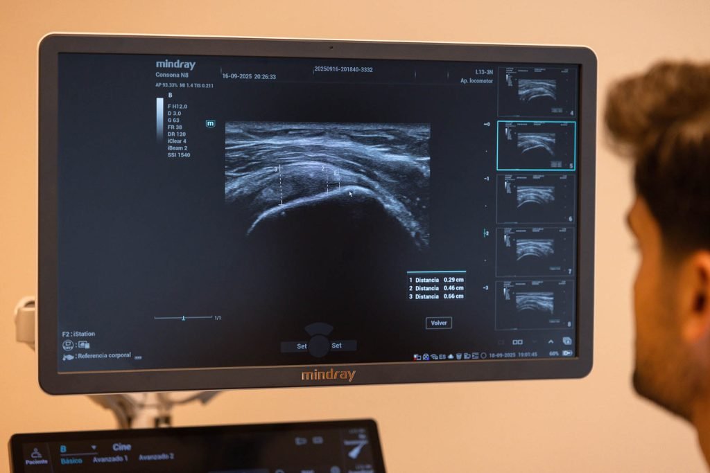 Pantalla de ecografía musculoesquelética para diagnóstico de lesiones en Zaragoza.